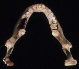 lm3 mandible